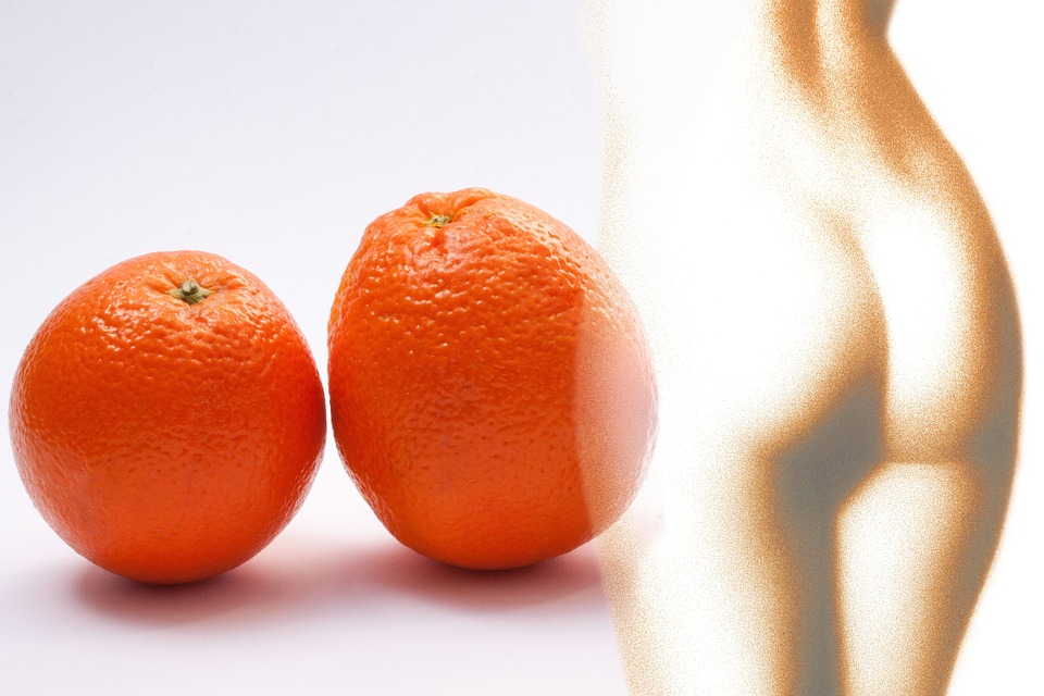 "Апельсиновые проблемы", или как избавиться от целлюлита